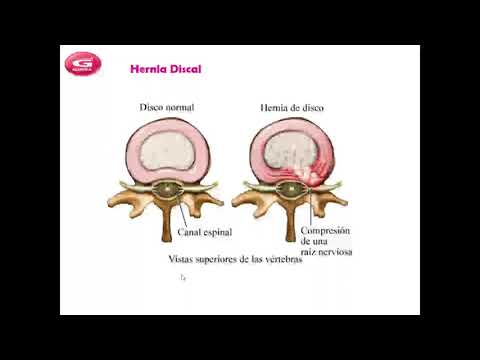 Fundamentos de la Ergonomía y la Columna Vertebral | Jose Guma SA - CAPV
